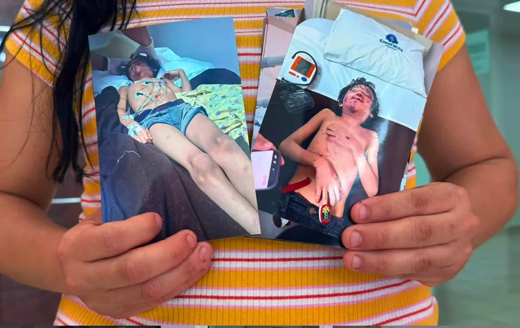 Madre teme que liberen a hombre acusado de agredir a sus hijos; uno de ellos perdió la vista